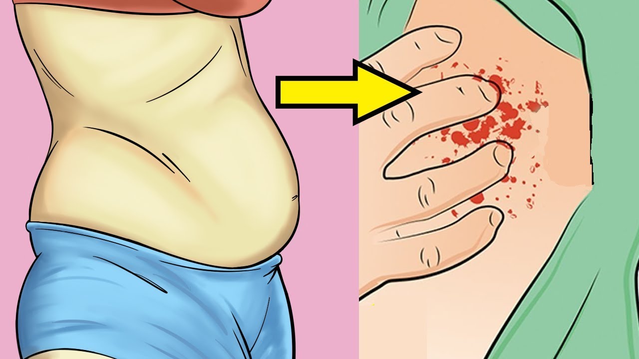 Azucar en el embarazo sintomas